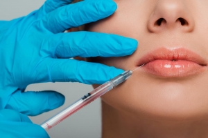 Lip Filler Injections: Gentle Approaches to Create a Harmonious Shape