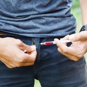 Dermal Fillers for Penis Augmentation: How the Procedure Works