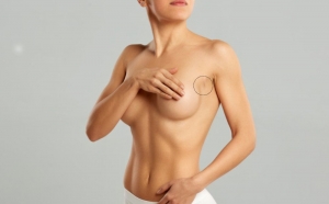 Breast Augmentation: How to Achieve Natural, Beautiful Results