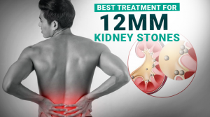 Best Treatment for 12 mm Kidney Stones