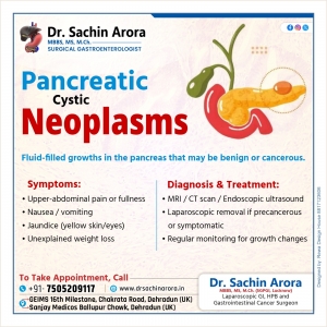 Understanding Pancreatic Cystic Neoplasms: Symptoms, Diagnosis & Modern Treatment Approaches
