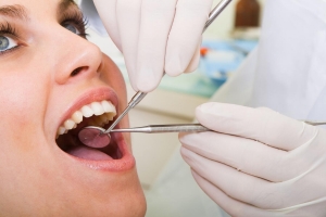 Unlocking the Secrets: What Is The Average Age To Get A Root Canal