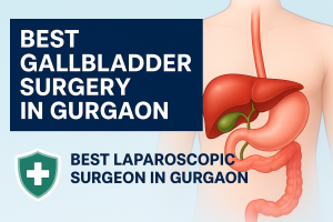 Best Gallbladder Surgery in Gurgaon