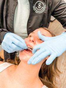 Looking for Invisalign in Salisbury? Here’s Where to Start	