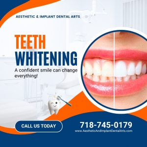 Is Tooth Whitening Safe for My Teeth and Gums?