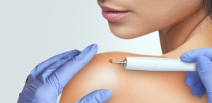 Can Skin Tag Removal in Dubai Be Pain-Free?