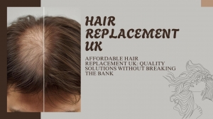 Affordable Hair Replacement UK: Quality Solutions Without Breaking the Bank