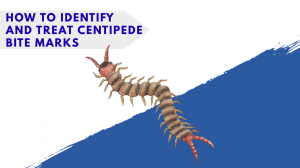 How to Identify and Treat Centipede Bite Marks