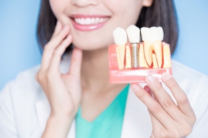 Dentures and Dental Implants: Understanding the Key Differences