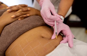 Sculpt Your Body Fast with Lemon Bottle Fat Dissolving