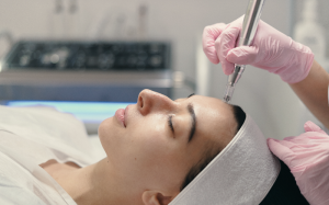 Microneedling Aftercare Tips: What to Do for Best Skin Results