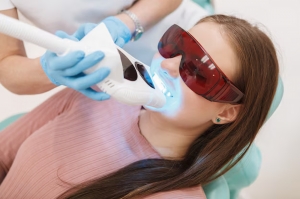 The Best Teeth Whitening Options in Richmond: A Guide to Treatments