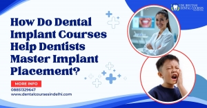 How Do Dental Implant Courses Help Dentists Master Implant Placement?
