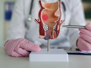 Professional Non Surgical Laser Treatment for Piles With Expert Doctors