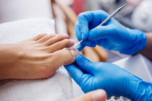 Ingrown toenail surgery in Varanasi treatment guide