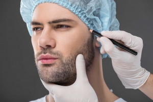 Who Qualifies as an Ideal Candidate for Beard Hair Transplant in Dubai?