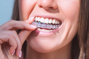 Why Do Teeth Shift After Braces Without a Retainer?