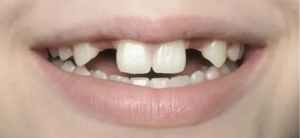 Reasons to hire an Professional Dentist for your tooth problem