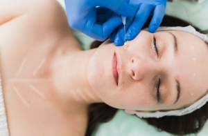 Boost Confidence and Skin Elasticity with Thread Lift Treatment Options