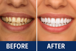 What Makes a Cosmetic Dentistry Office Trusted for “Before and After” Transformations?