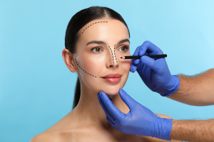Rhinoplasty Myths vs Facts