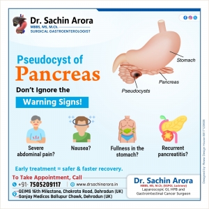 Pseudocyst of the Pancreas: Warning Signs, Causes, and the Importance of Early Treatment