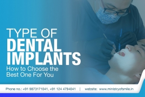 How the Ministry of Smile Helped Me Overcome My Dental Worries with Perfect Implants?