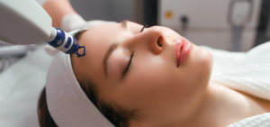 What to Expect During Your First Pico Laser Session