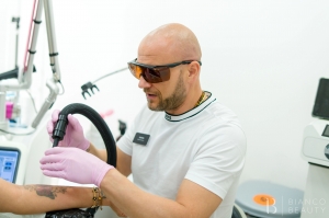 Fading vs Full Removal: Which Option Is Right for You?