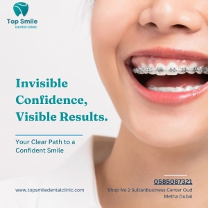 Transform Your Smile with Invisible Braces in Dubai!