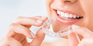 Invisalign Treatment White Plains: How Busy Professionals Can Utilize Clear Aligners