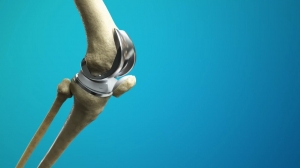 Your Path to a Pain-Free Life: Total Knee Replacement Surgery in Delhi