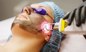Glow Renewed with Modern Laser Skin Treatment Today
