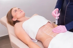 Can Liposuction in Islamabad Help With Stubborn Belly Fat?