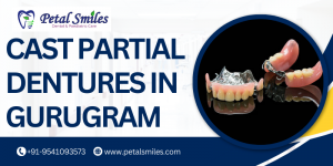Cast Partial Dentures in Gurugram
