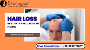 Hair Loss: What are the Ways to Prevent It?