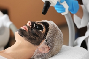 Is Laser Carbon Peel Better Than Chemical Peel?