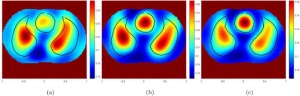 Electrical Impedance Tomography