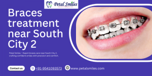 Braces Treatment Near South City 2