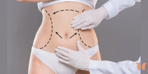 Body Contouring After Liposuction: Tips and Tricks