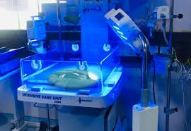 Infant Phototherapy Devices Market Size, Share and Growth Forecast 2025-2033