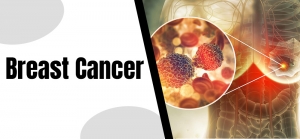 Types of Breast Cancer Surgery