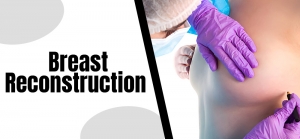 Categories of Surgical Breast Reconstruction