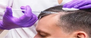 How Many Sessions Are Required for PRP Hair Treatment in Islamabad?