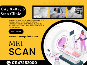 Is MRI Scan Safe? A comprehensive Guide For MRI Scan