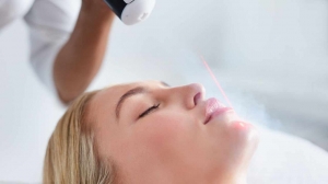 Fractional CO2 Laser: The Ultimate Solution for Skin Renewal