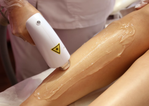 The Ultimate Guide to Laser Hair Removal for Smoother Skin