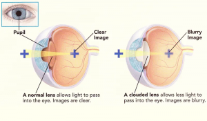 Eye Care OKC Tips for Contact Lens Wearers