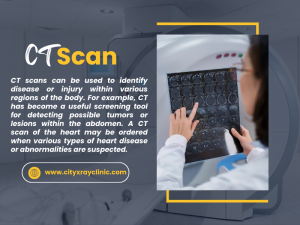 Detailed Overview About CT Scan - Price, Benefit And Purpose