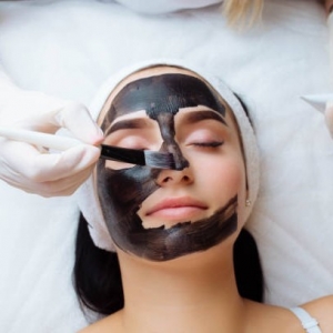The Ultimate Guide to Spectra Laser Carbon Peel